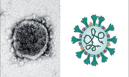 SARS-CoV-2 entwaffnet menschliche Zellen durch „Shutdown“ der Proteinfabriken