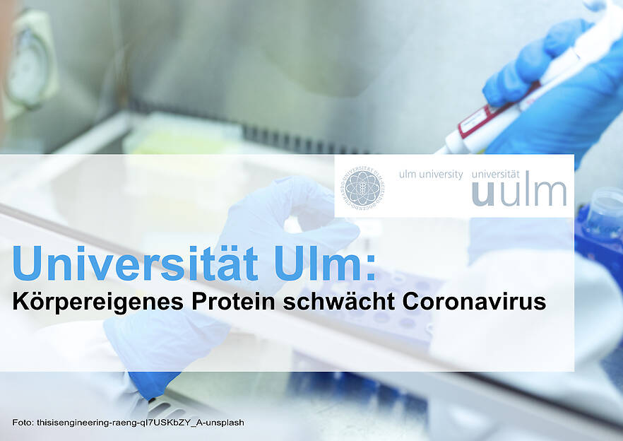 Universität Ulm: Körpereigenes Protein schwächt Coronavirus