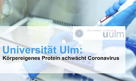 Universität Ulm: Körpereigenes Protein schwächt Coronavirus