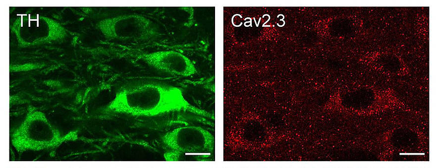 Blockade spezieller Kalzium-Kanäle kann Nervenzellen retten