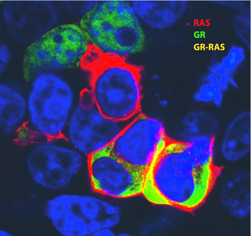 Glucocorticoid-Rezeptor und RAS-Onkogen bremsen Krebsentstehung aus
