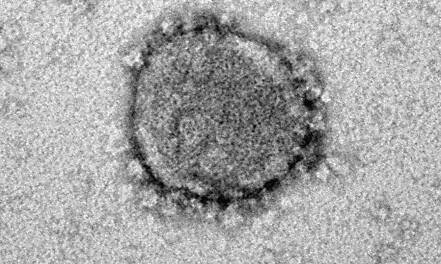 Zelleigener Faktor erkennt und zerschneidet Coronavirus-RNA