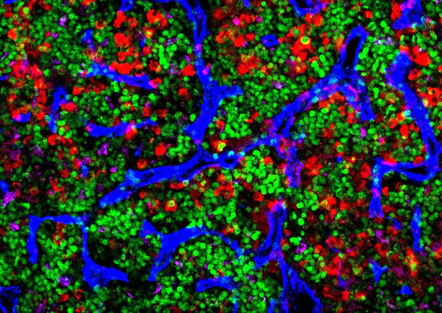 Nischen im Knochenmark schützen hämatopoetische Stammzellen vor Alterung